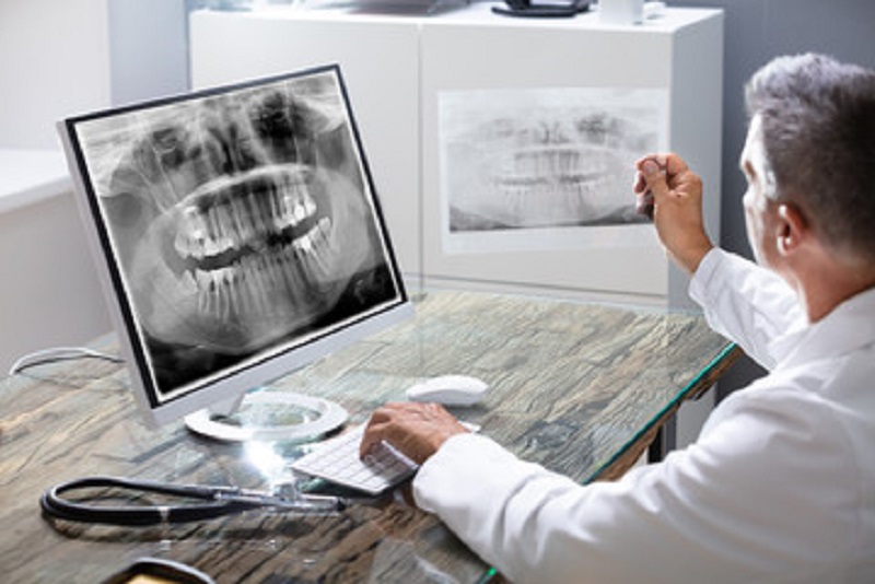 Comprehensive Dental Checkup with OPG & IOPA Small Xray
