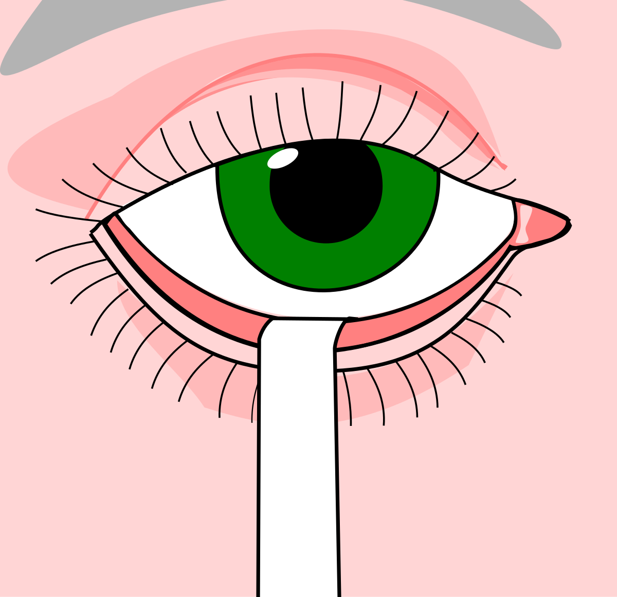 DIAGNOSTICS Both Eye Schirmer's test