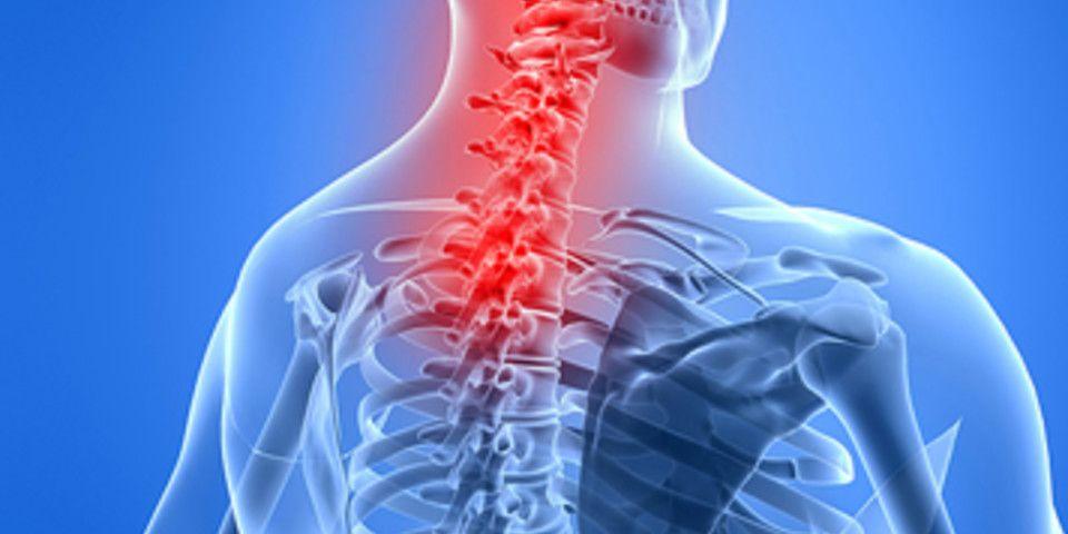 Cervical Spine Decompression N Fusion At 2 Levels