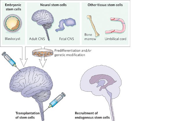 Stem Cell therapy for Neurological Disorder