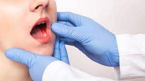 Oral cancer Treatment, India