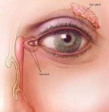 ORBIT AND OCULOPLASTY Punctoplasty Single Eye