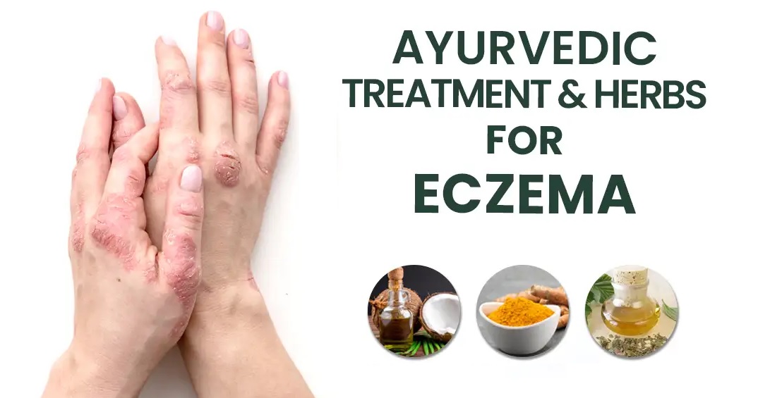 Ayurveda Treatment for Eczema