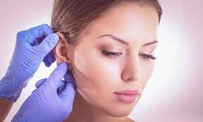 Ear Surgery (Pinnaplasty)