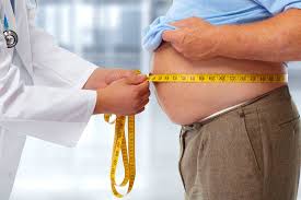 Bariatric Surgery for Weight Loss