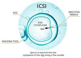 Intracytoplasmic Sperm Injection Procedure ICSI, Thailand
