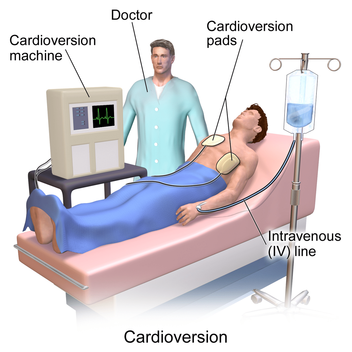 Cardioversion, Iran
