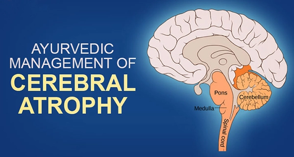Ayurveda Treatment for Cerebral Atrophy