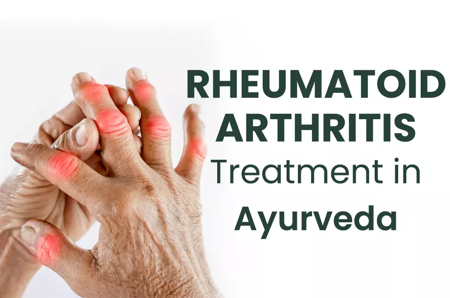 Ayurveda Treatment for Rheumatoid Arthritis, India