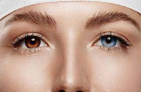 Iris Implant (Eye color change surgery)