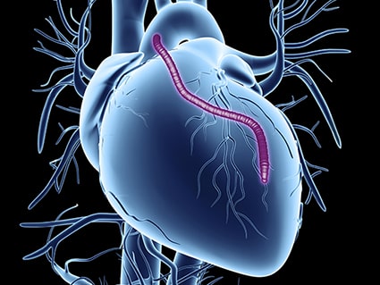 CABG