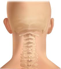Cervical Posterior Spinal Fusion Surgery, Canada