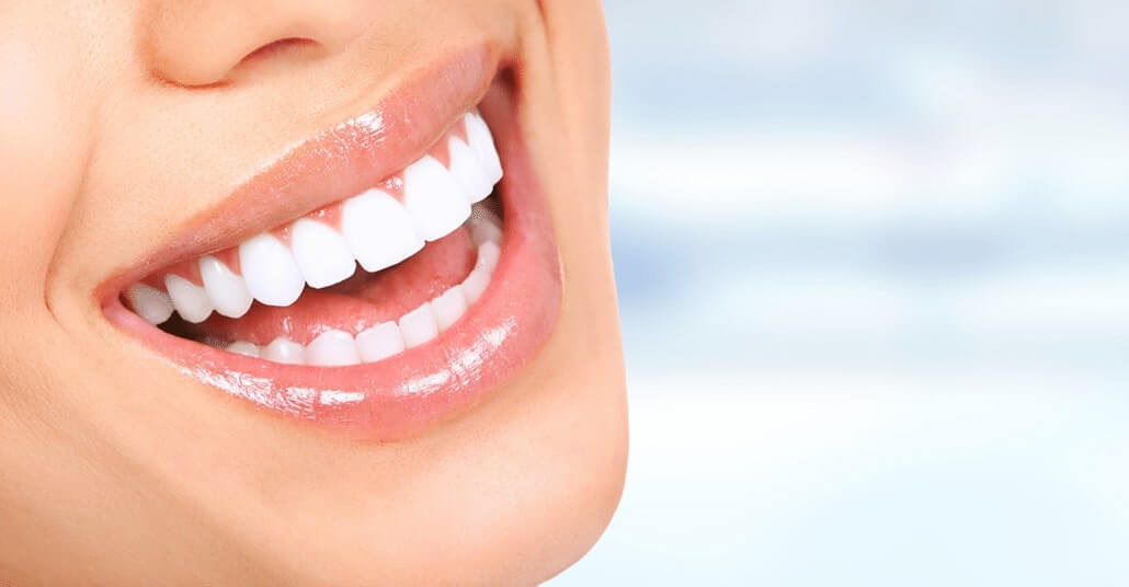 Smile Design Procedure Hollywood Smile Design