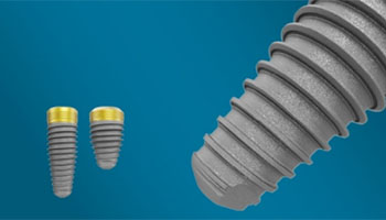 Individual Implants Nobel Replace Sweden