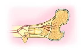 Bone Marrow Transplant Autologous