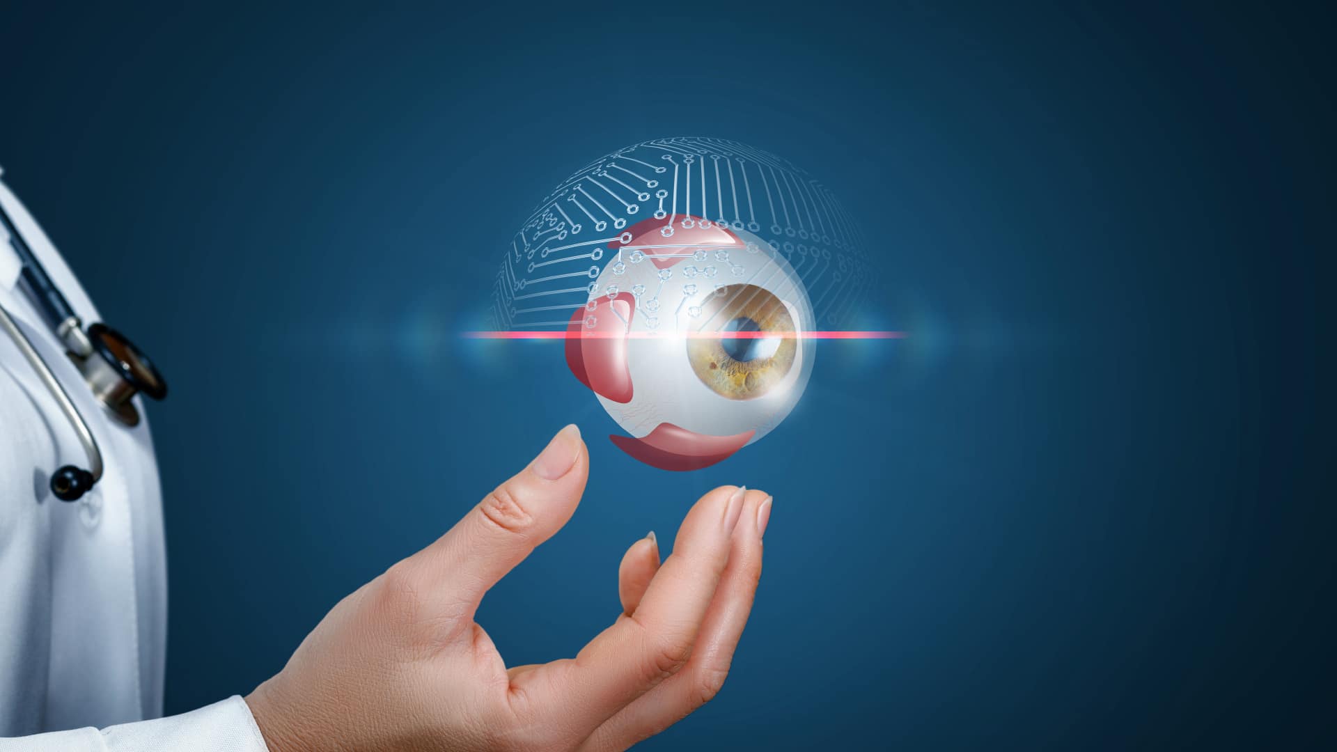 CATARACT phaco with Indian Multofocal PCIOL Single Eye