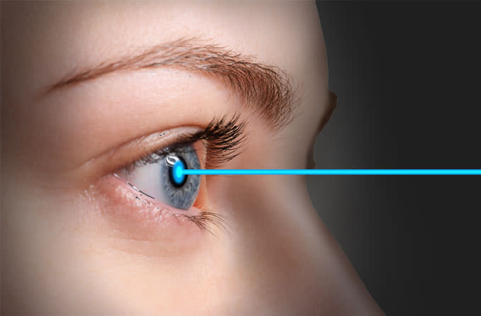 REFRACTIVE SURGICAL PROCEDURE-femto-LASIK (Both Eyes)