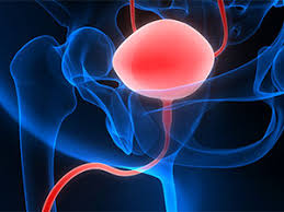 Neobladder Construction