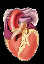 Conduit Repair with contegra co