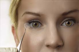 CORNEAL AND OCULAR SURFACE PROCEDURES- Aminiotic membrane grafting- Single Eye