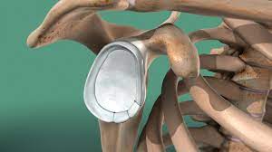 Arthroscopic Bankart Repair
