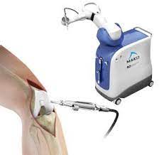Unilateral Knee Replacement Robotic