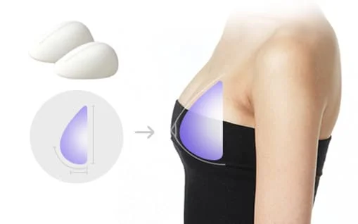 Breast Enlargement Mammoplasty