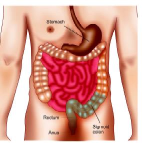 Abdominoperineal Resection