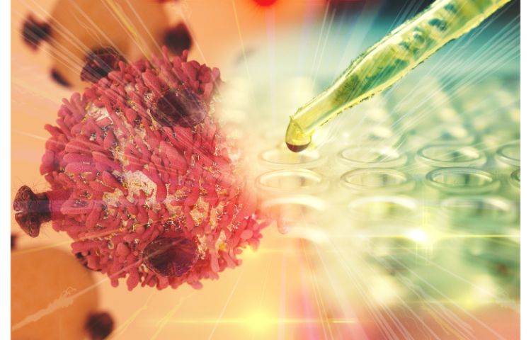 Bone Marrow Transplant Allogenic